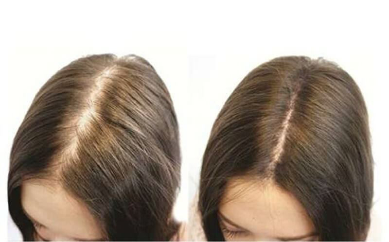 Đánh giá của khách hàng kích thích mọc tóc Qik Hair