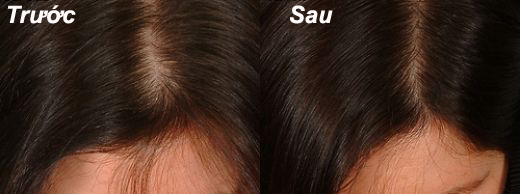 Đánh giá của khách hàng kích thích mọc tóc Qik Hair