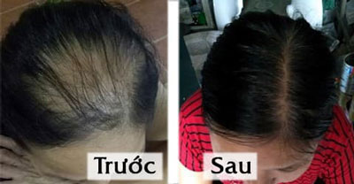 Dr.FORHAIR review
