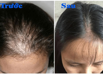 Dr.FORHAIR review