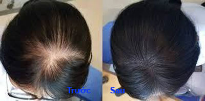 Dr.FORHAIR review