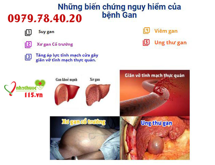 biến chứng bệnh gan