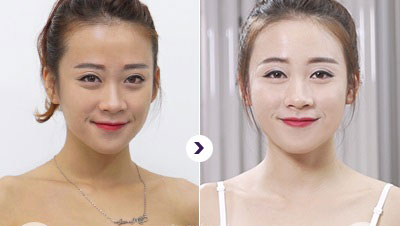 khách hàng sử dụng HAG